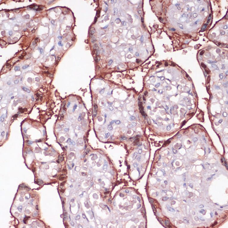 Immunohistochemistry - Anti-S100P Antibody (A88205) - Antibodies.com