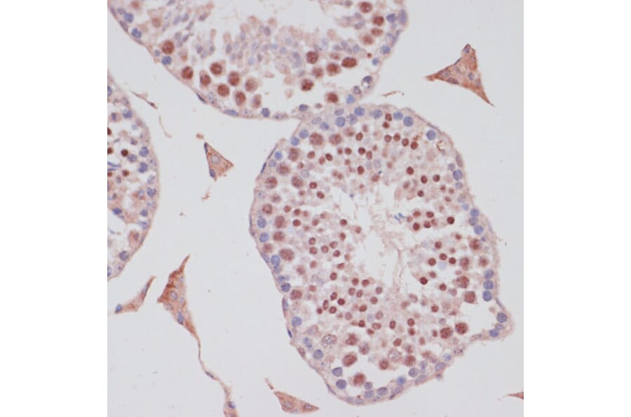 Immunohistochemistry - Anti-S100P Antibody (A88205) - Antibodies.com