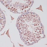 Immunohistochemistry - Anti-S100P Antibody (A88205) - Antibodies.com