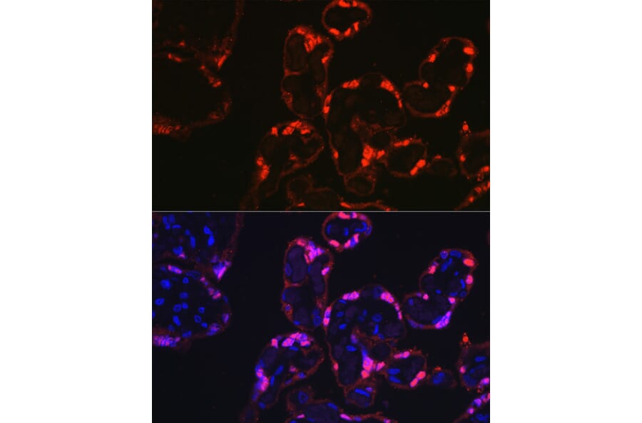 Immunofluorescence - Anti-S100P Antibody (A88205) - Antibodies.com