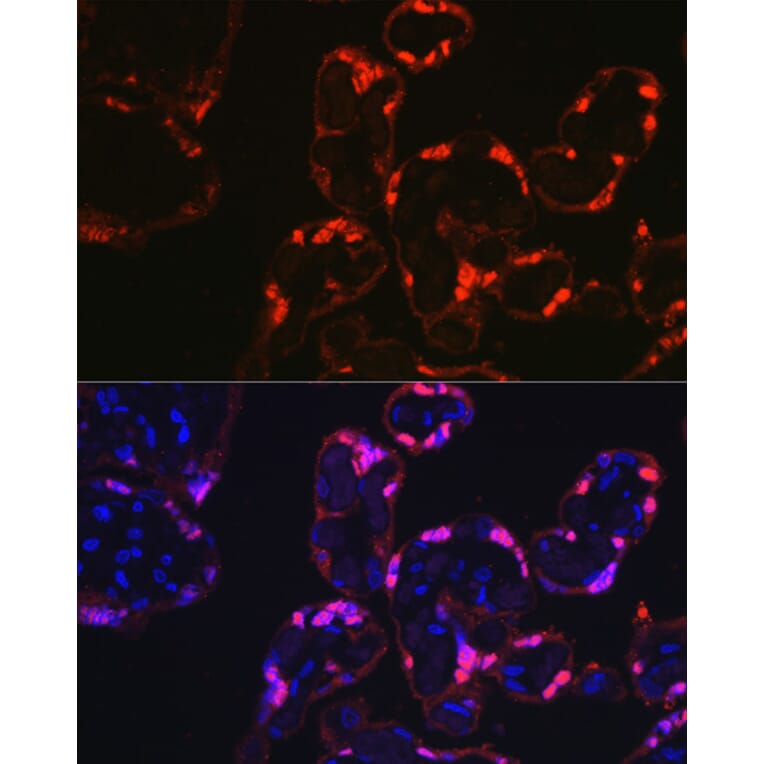 Immunofluorescence - Anti-S100P Antibody (A88205) - Antibodies.com