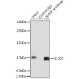 Western Blot - Anti-S100P Antibody (A88205) - Antibodies.com