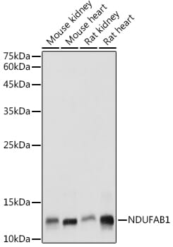 Western blot analysis of extracts of various cell lines, using Anti-NDUFAB1 Antibody (A14657) at 1:1,000 dilution.
Secondary antibody: Goat Anti-Rabbit IgG (H+L) (HRP) (AS014) at 1:10,000 dilution.
Lysates / proteins: 25µg per lane.
Blocking buffer: 3% non-fat dry milk in TBST.
Detection: ECL Enhanced Kit (RM00021).
Exposure time: 90s.