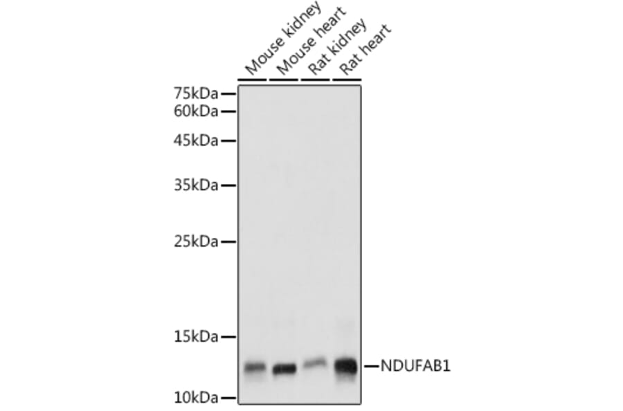 Western Blot - Anti-NDUFAB1 Antibody (A88206) - Antibodies.com