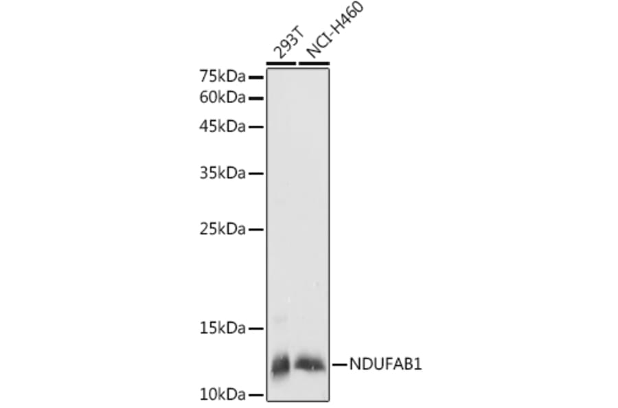 Western Blot - Anti-NDUFAB1 Antibody (A88206) - Antibodies.com