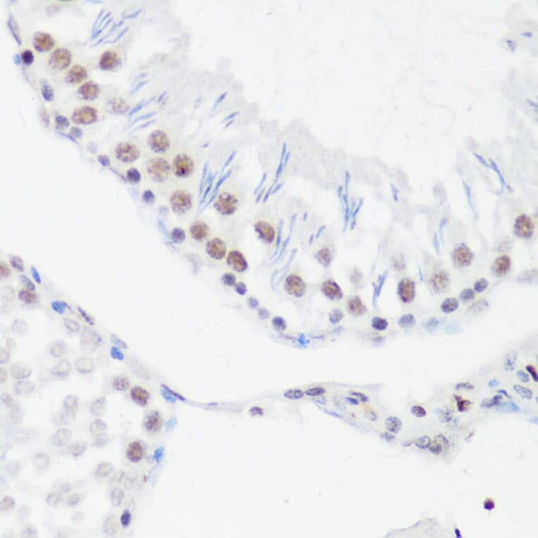 Immunohistochemistry - Anti-Histone H4 (mono methyl Arg3) Antibody (A88207) - Antibodies.com