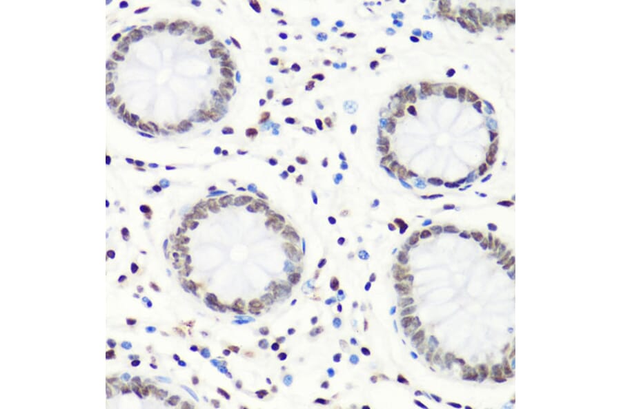 Immunohistochemistry - Anti-Histone H4 (mono methyl Arg3) Antibody (A88207) - Antibodies.com
