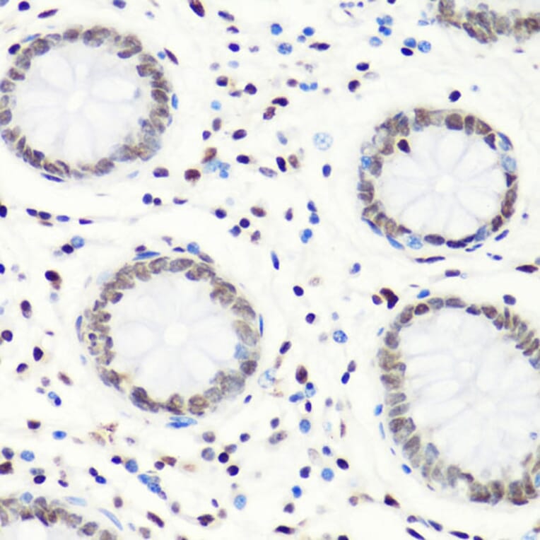 Immunohistochemistry - Anti-Histone H4 (mono methyl Arg3) Antibody (A88207) - Antibodies.com