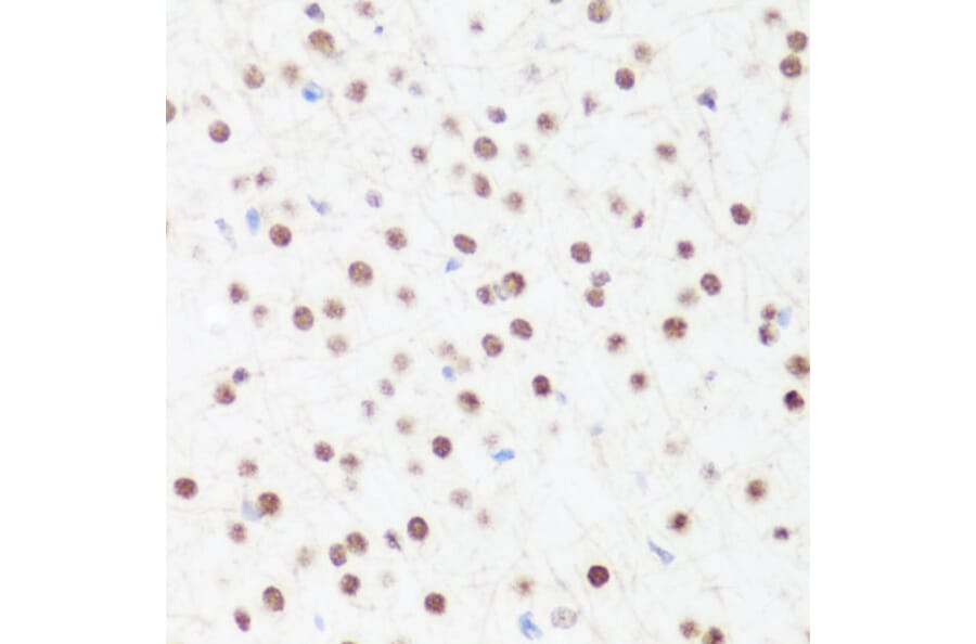 Immunohistochemistry - Anti-Histone H4 (mono methyl Arg3) Antibody (A88207) - Antibodies.com
