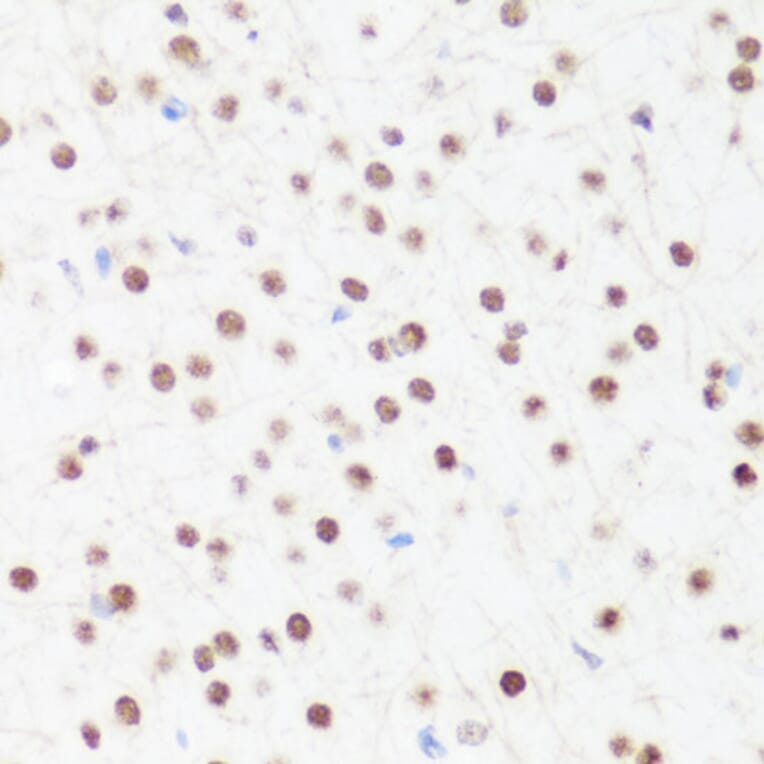 Immunohistochemistry - Anti-Histone H4 (mono methyl Arg3) Antibody (A88207) - Antibodies.com