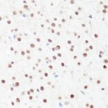 Immunohistochemistry - Anti-Histone H4 (mono methyl Arg3) Antibody (A88207) - Antibodies.com