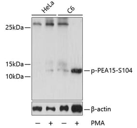 Western Blot - Anti-PEA15 (phospho Ser104) Antibody (A88208) - Antibodies.com