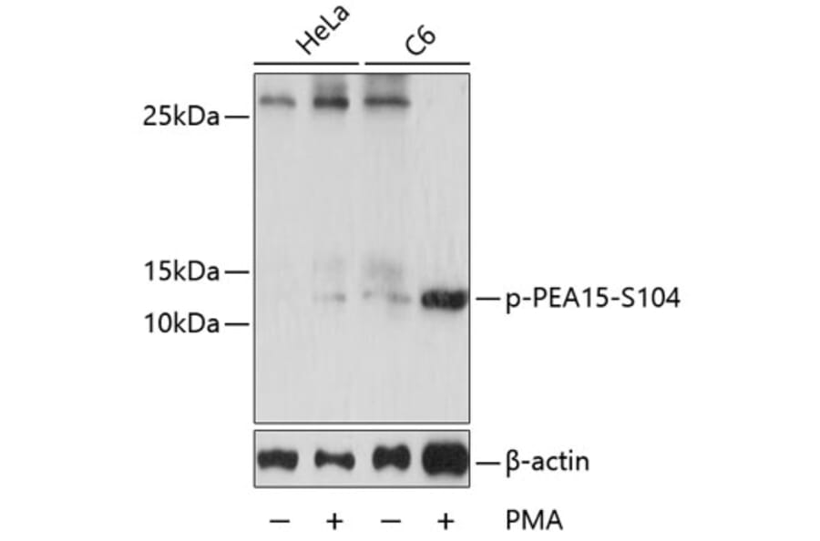 Western Blot - Anti-PEA15 (phospho Ser104) Antibody (A88208) - Antibodies.com