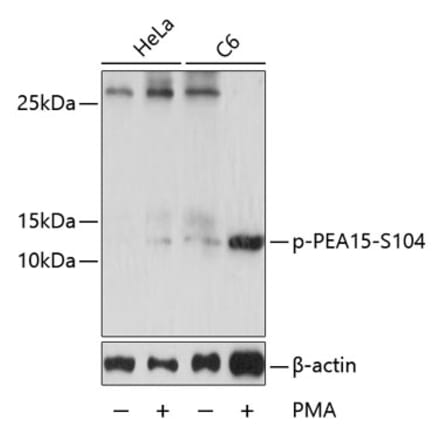 Western Blot - Anti-PEA15 (phospho Ser104) Antibody (A88208) - Antibodies.com