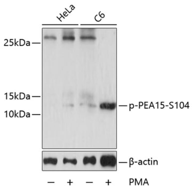 Western Blot - Anti-PEA15 (phospho Ser104) Antibody (A88208) - Antibodies.com