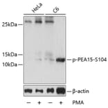 Western Blot - Anti-PEA15 (phospho Ser104) Antibody (A88208) - Antibodies.com