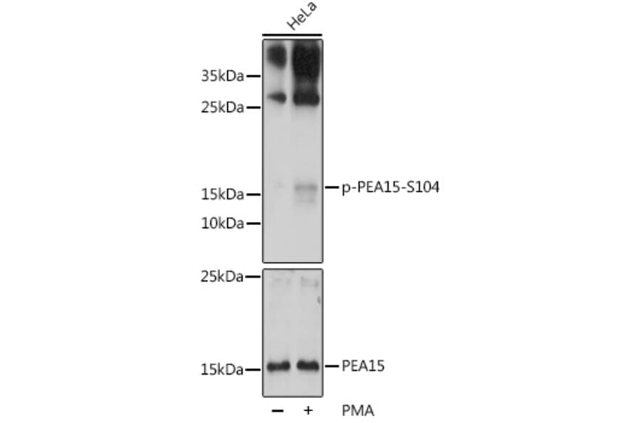 Western Blot - Anti-PEA15 (phospho Ser104) Antibody (A88208) - Antibodies.com