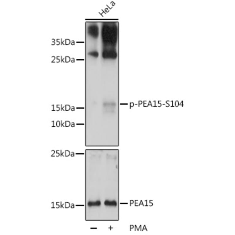 Western Blot - Anti-PEA15 (phospho Ser104) Antibody (A88208) - Antibodies.com