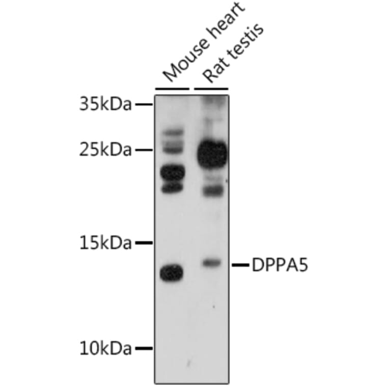 Western Blot - Anti-Dppa5 Antibody (A88209) - Antibodies.com
