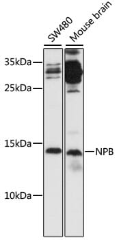 Western blot analysis of extracts of various cell lines, using Anti-NPB Antibody (A16612) at 1:1,000 dilution.
Secondary antibody: Goat Anti-Rabbit IgG (H+L) (HRP) (AS014) at 1:10,000 dilution.
Lysates / proteins: 25µg per lane.
Blocking buffer: 3% non-fat dry milk in TBST.
Detection: ECL Basic Kit (RM00020).
Exposure time: 90s.