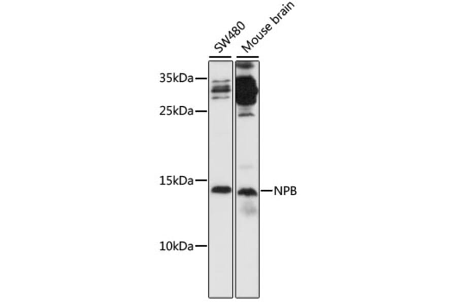 Western Blot - Anti-NPB Antibody (A88210) - Antibodies.com