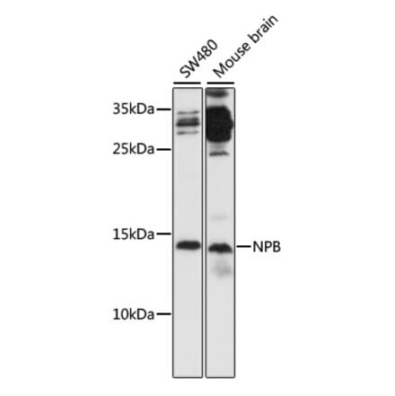 Western Blot - Anti-NPB Antibody (A88210) - Antibodies.com