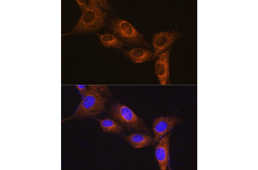 Immunofluorescence - Anti-NPB Antibody (A88210) - Antibodies.com