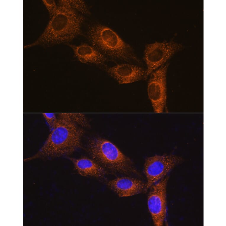Immunofluorescence - Anti-NPB Antibody (A88210) - Antibodies.com