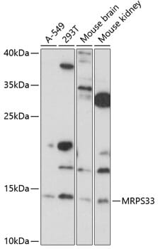 Western blot analysis of extracts of various cell lines, using Anti-MRPS33 Antibody (A14893) at 1:1,000 dilution.
Secondary antibody: Goat Anti-Rabbit IgG (H+L) (HRP) (AS014) at 1:10,000 dilution.
Lysates / proteins: 25µg per lane.
Blocking buffer: 3% non-fat dry milk in TBST.
Detection: ECL Basic Kit (RM00020).
Exposure time: 90s.