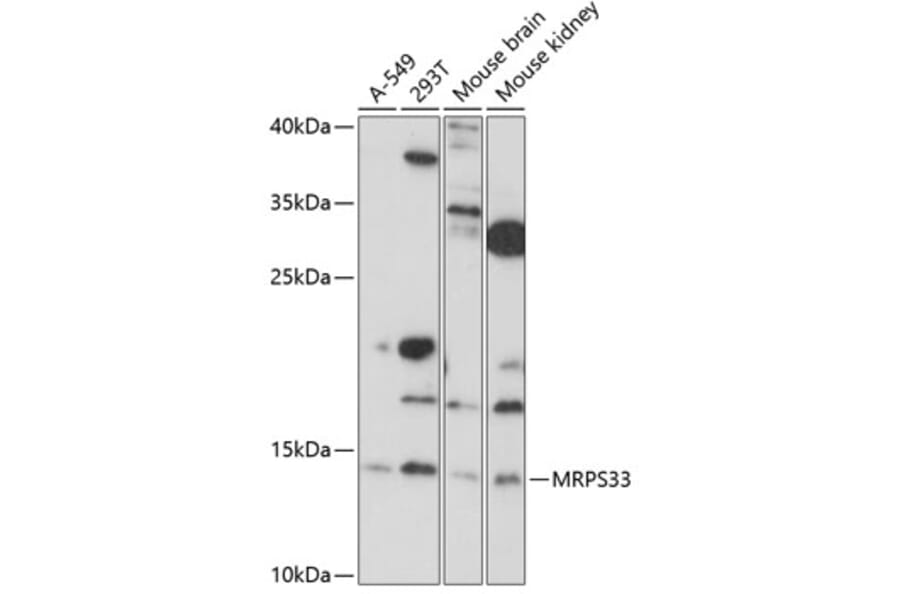 Western Blot - Anti-MRPS33 Antibody (A88212) - Antibodies.com