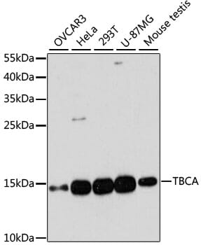 Western blot analysis of extracts of various cell lines, using Anti-TBCA Antibody (A13050) at 1:3000 dilution.
Secondary antibody: Goat Anti-Rabbit IgG (H+L) (HRP) (AS014) at 1:10,000 dilution.
Lysates / proteins: 25µg per lane.
Blocking buffer: 3% non-fat dry milk in TBST.
Detection: ECL Basic Kit (RM00020).
Exposure time: 90s.