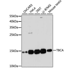Western Blot - Anti-CFA Antibody (A88213) - Antibodies.com