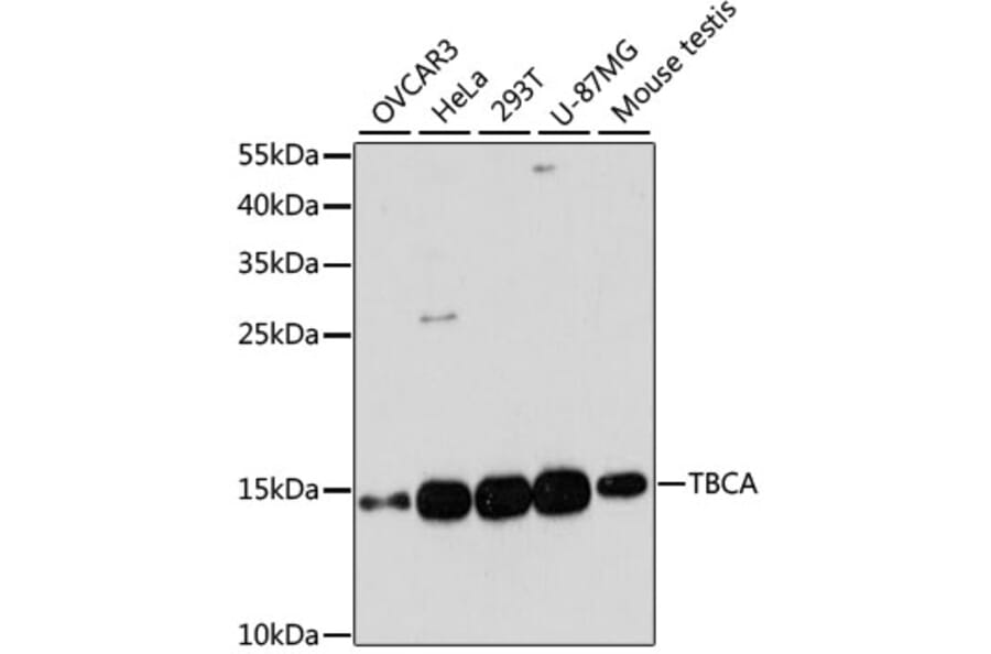 Western Blot - Anti-CFA Antibody (A88213) - Antibodies.com