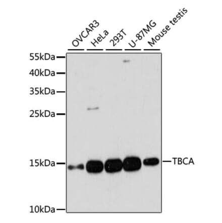 Western Blot - Anti-CFA Antibody (A88213) - Antibodies.com