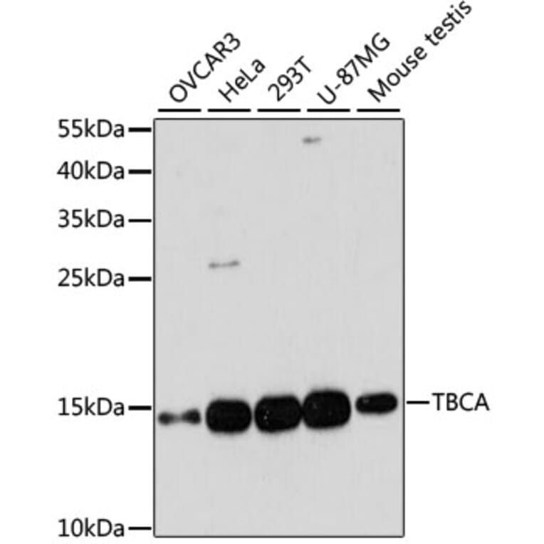 Western Blot - Anti-CFA Antibody (A88213) - Antibodies.com