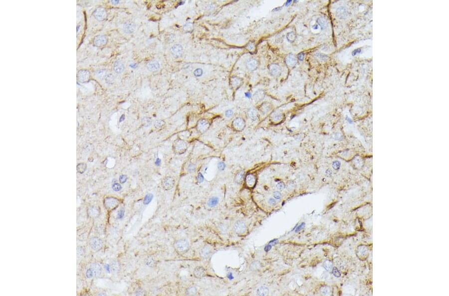Immunohistochemistry - Anti-CFA Antibody (A88213) - Antibodies.com