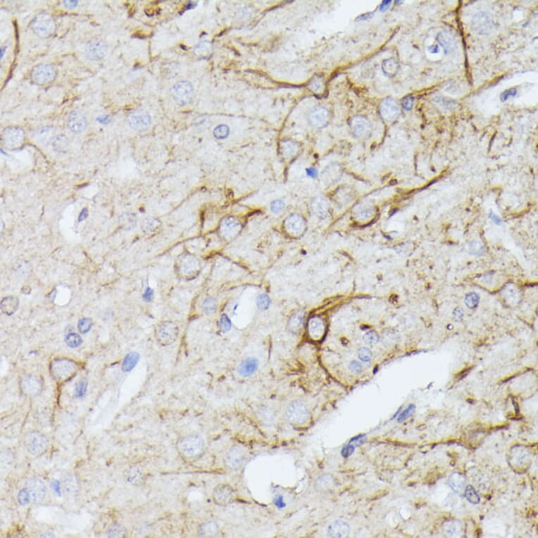 Immunohistochemistry - Anti-CFA Antibody (A88213) - Antibodies.com