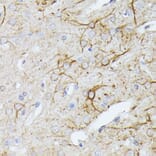 Immunohistochemistry - Anti-CFA Antibody (A88213) - Antibodies.com