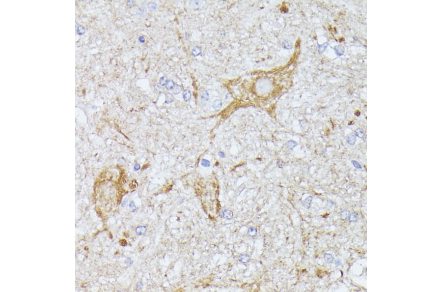 Immunohistochemistry - Anti-CFA Antibody (A88213) - Antibodies.com