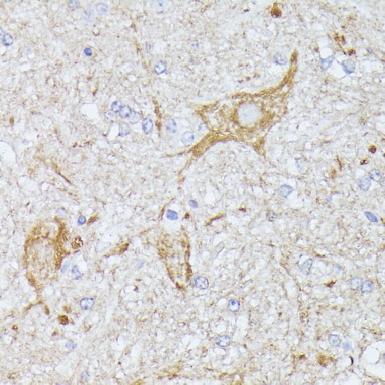 Immunohistochemistry - Anti-CFA Antibody (A88213) - Antibodies.com