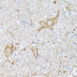 Immunohistochemistry - Anti-CFA Antibody (A88213) - Antibodies.com