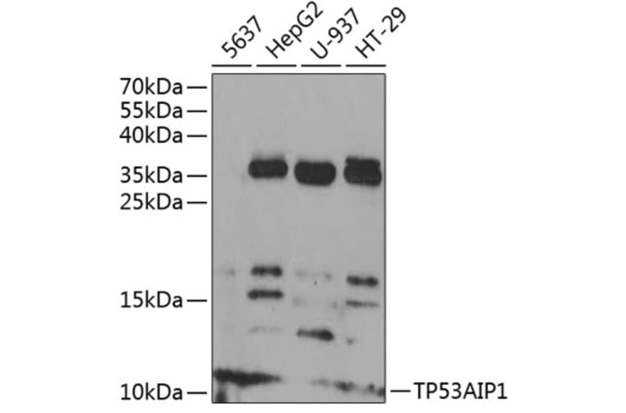 Western Blot - Anti-p53 AIP1 Antibody (A88214) - Antibodies.com