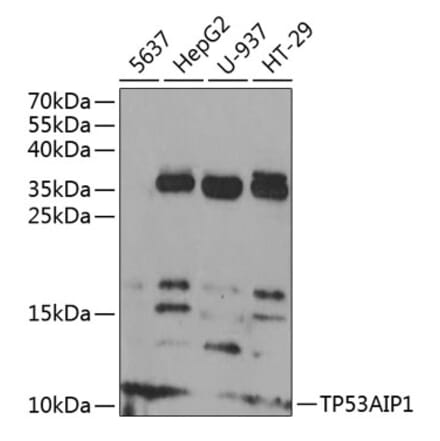 Western Blot - Anti-p53 AIP1 Antibody (A88214) - Antibodies.com