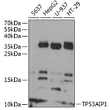 Western Blot - Anti-p53 AIP1 Antibody (A88214) - Antibodies.com