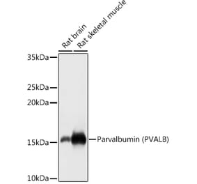 Western Blot - Anti-Parvalbumin Antibody (A88215) - Antibodies.com