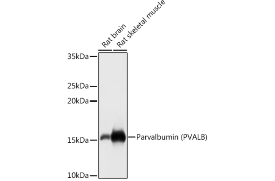 Western Blot - Anti-Parvalbumin Antibody (A88215) - Antibodies.com