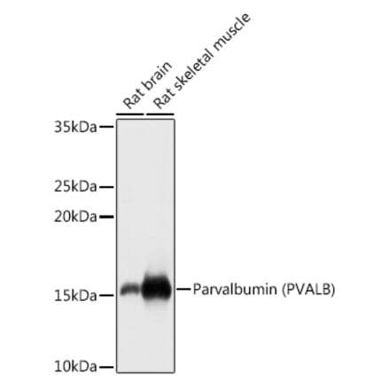Western Blot - Anti-Parvalbumin Antibody (A88215) - Antibodies.com