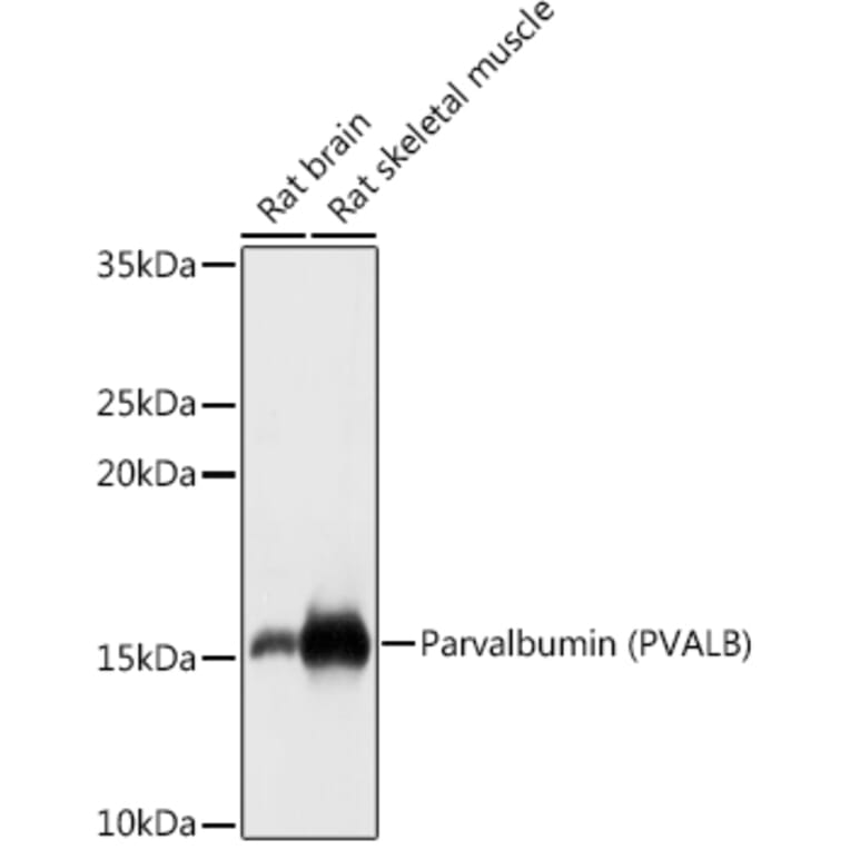 Western Blot - Anti-Parvalbumin Antibody (A88215) - Antibodies.com