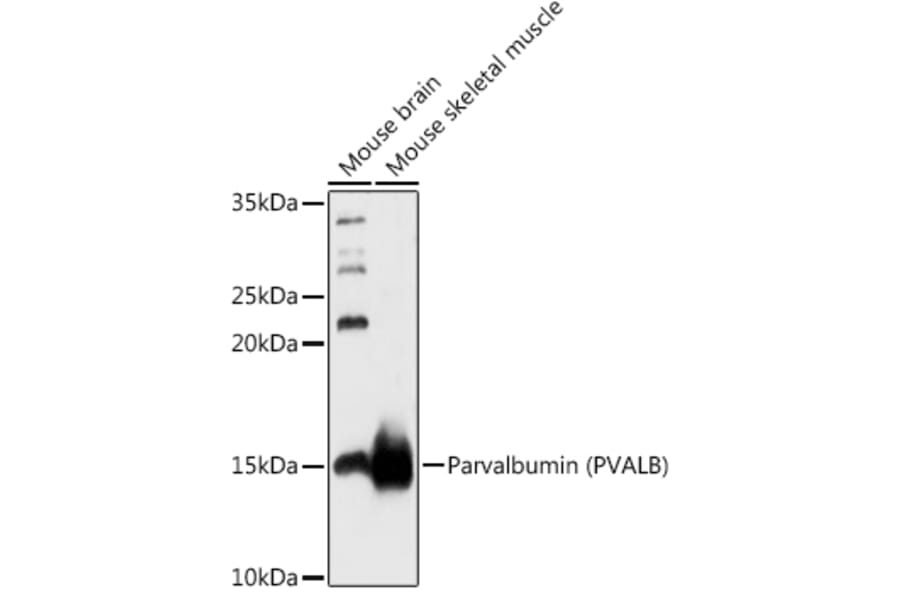 Western Blot - Anti-Parvalbumin Antibody (A88215) - Antibodies.com