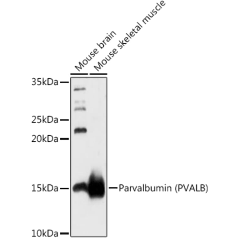 Western Blot - Anti-Parvalbumin Antibody (A88215) - Antibodies.com